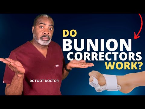 Video: Sunt siguri corectorii de bunion?