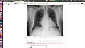 CheXNet "Production" Pipeline Creation
