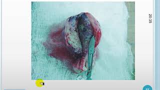 CyM ginecobtetricia - OBSTETRICIA 2 C
