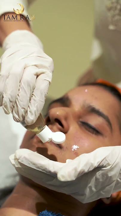 Lactic Acid Peel for Glowing Skin | Real-Time Results at Tamira life  | Chennai
