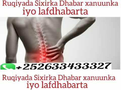 Ruqiyada Burisa Sixirka Dhabar Xanuunka Iyo Lafdhabarta Insha Allah