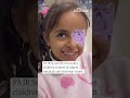 The Gaza girl whose face was ‘ripped off’ by an Israeli missile