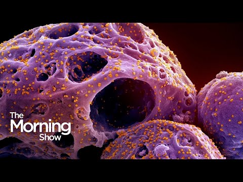 Video: Ar koronavirusas gali būti latentinis?