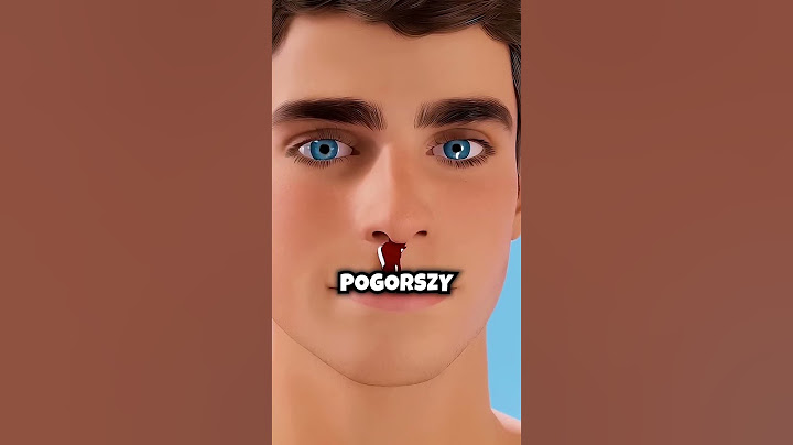 Jak Zatrzymać Krwawienie Z Nosa?!🩸