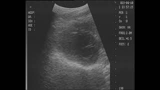 [Ultrasound] - Long Resting Heartbeat