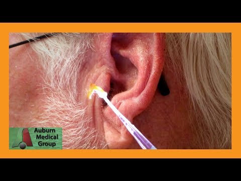 English Teacher's Ear Wax Removal | Auburn Medical Group