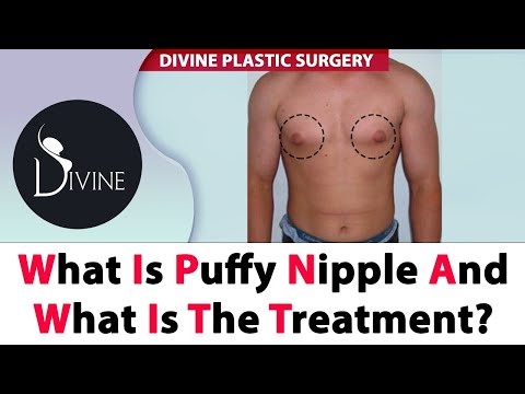 What is Puffy Nipple and What is The Treatment?