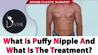 What is Puffy Nipple and What is The Treatment?