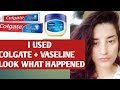 DOES APPLYING COLGATE AND VASELINE ON FACE WORK ? TRYING ON AND REVIEW