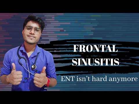 Video: Frontitis - Treatment Of Frontal Sinusitis With Folk Remedies And Methods