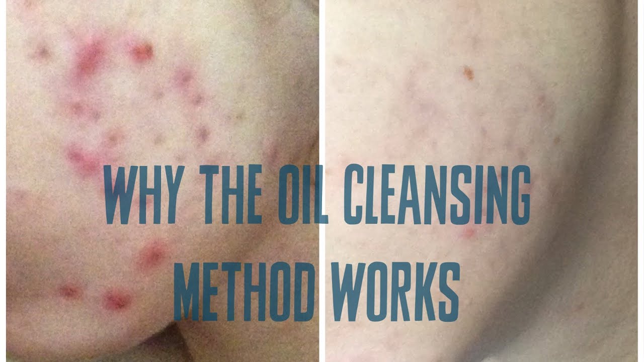 The Oil Cleansing Method Why so many people are loving CRUDE Skincare