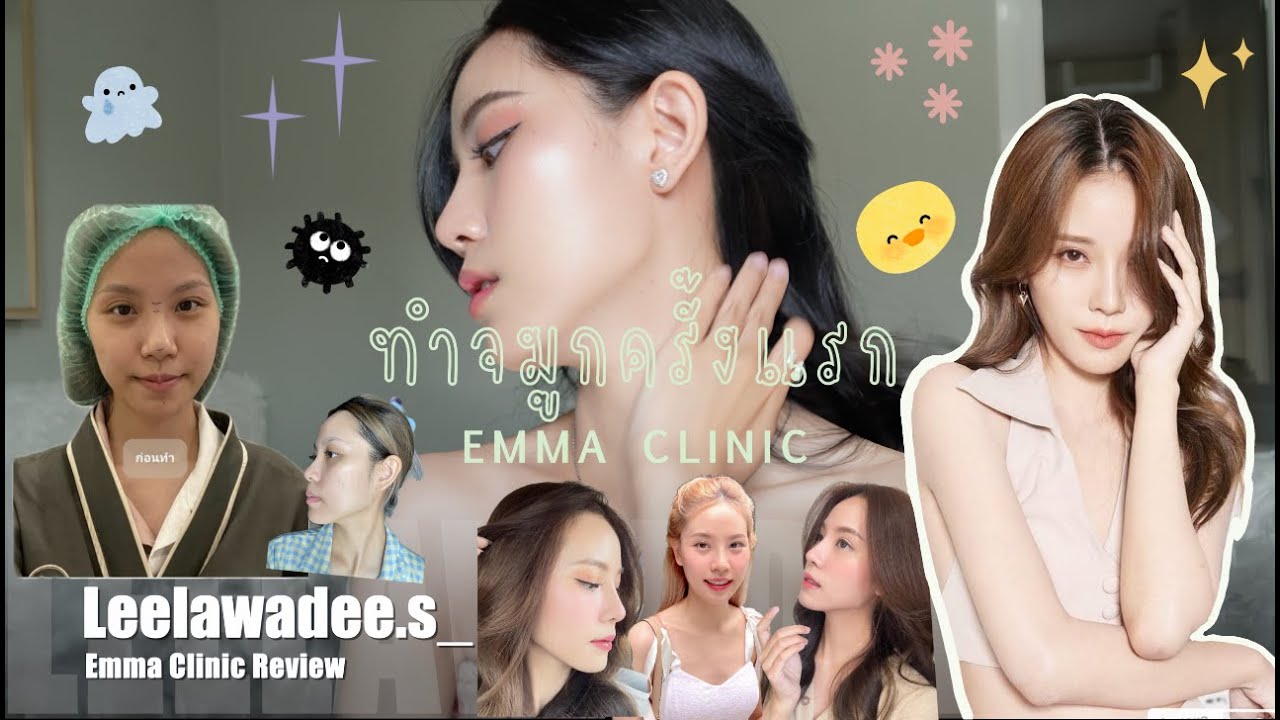 ทำจมูกครั้งแรกในชีวิต EMMA Clinic | Leelawadee.s_