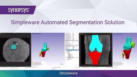 Simpleware Automated Segmentation Solution | Synopsys