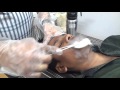 Cryo slush on Acne (Dr Bhutada Laser India)