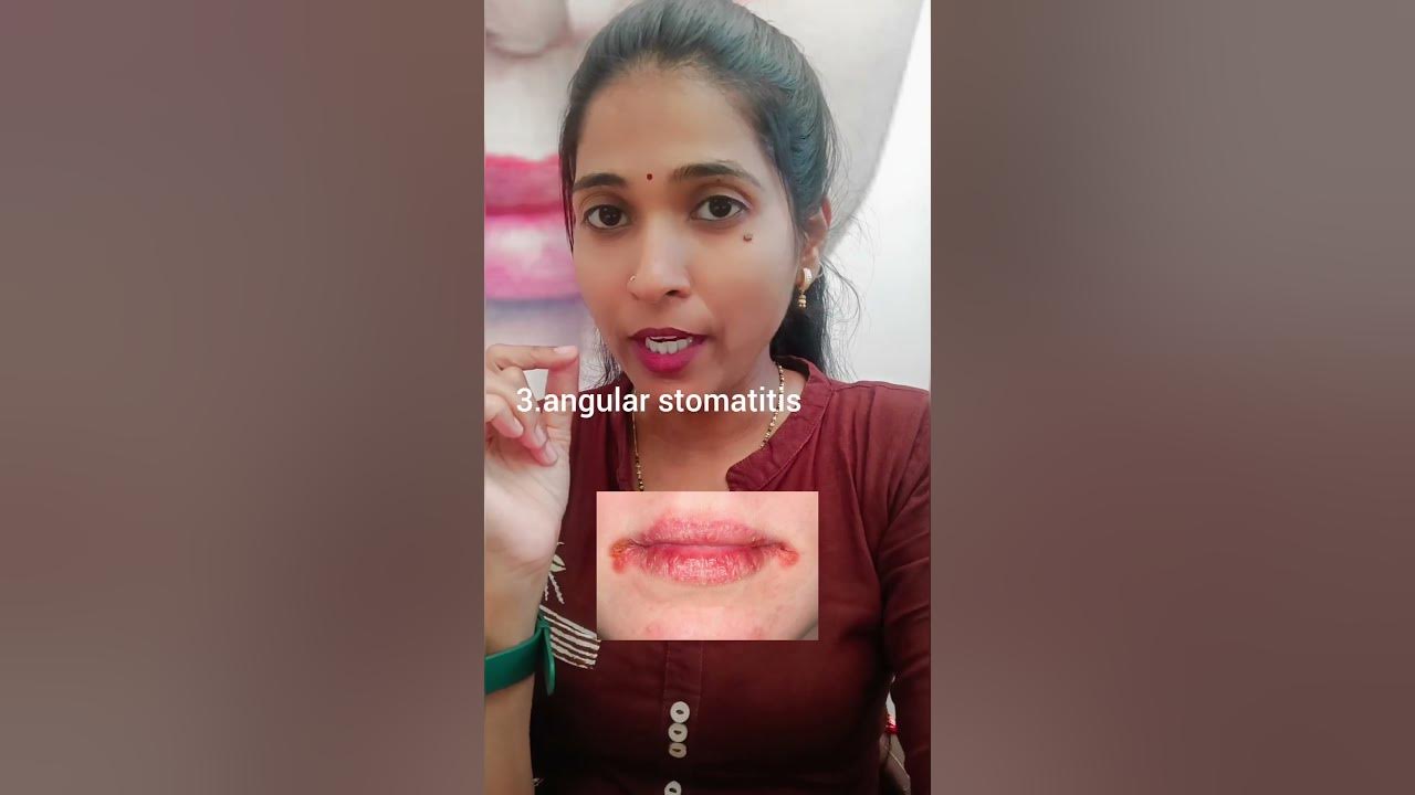 vitamin-b12-ki-kami-se-hone-wale-skin-problems-vitamin-skincare