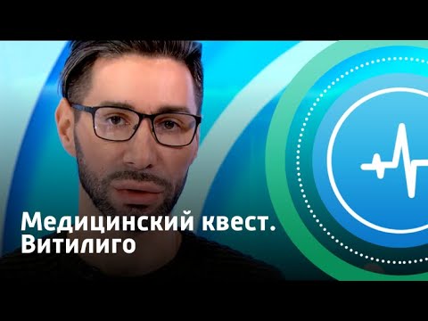 Медицинский квест. Витилиго | Телеканал «Доктор»