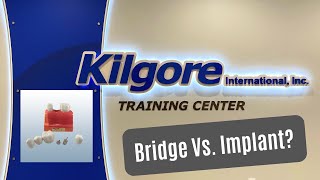 Kilgore International -  Bridge Vs. Implant | Dental Patient Education