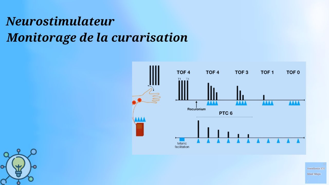 Neurostimulateur Monitorage de la curarisation