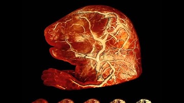 Instant Volume Visualization using Maximum Intensity Difference Accumulation (2)