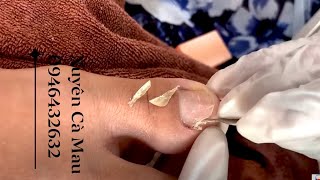 How to Repair Nails easy # 445 - Xuyen Nail