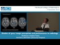 Shades of grey image perception and performance in radiology