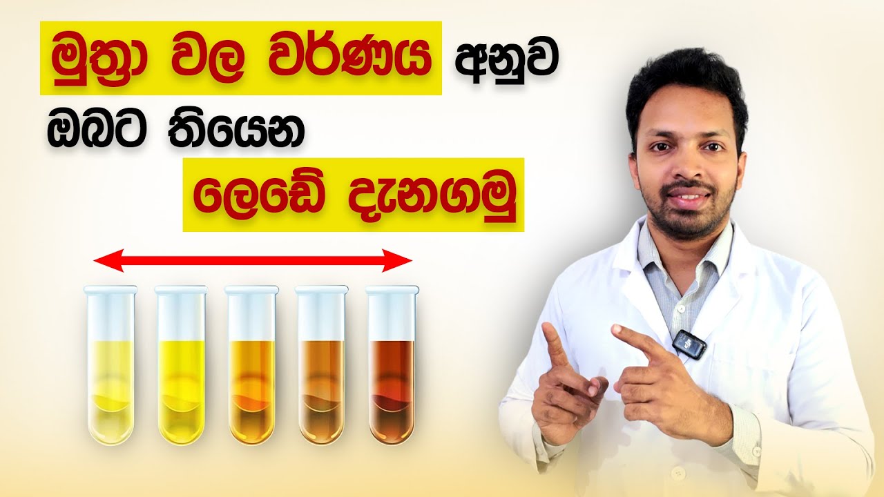 මුත්‍රා වල වර්ණය අනුව ඔබට තියෙන ලෙඩෙ දැනගමු | Urine Colors Explained |  Muthra Wala Pata
