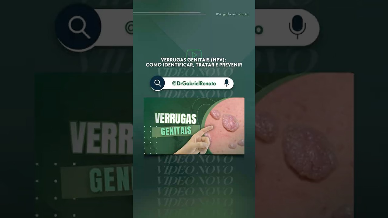 Verrugas genitais podem ser silenciosas. Fique atento!