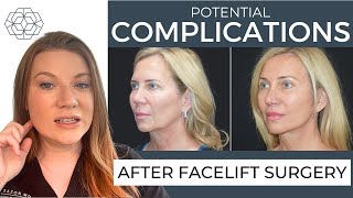 Potential Facelift Complications