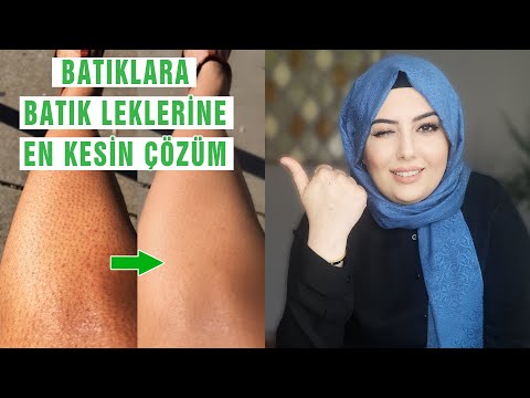 Video: Siyah Bir Bacaktan Nasıl Kurtulurum