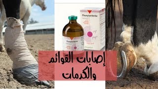 طريقة التعامل مع إصابات القوائم والكدمات فينيل ارثريت مضاد التهاب