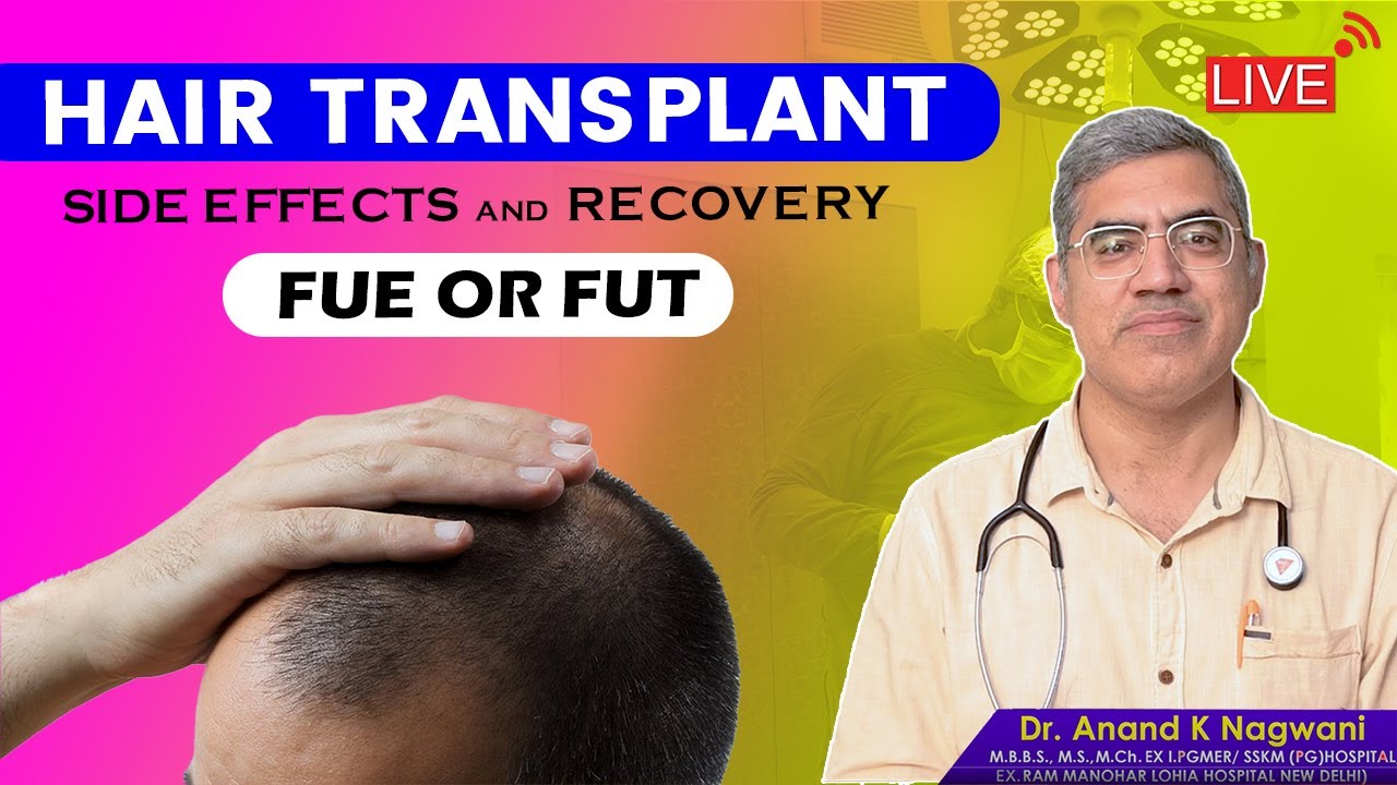 Hair transplant Procedures, Types, Side effects and Recovery