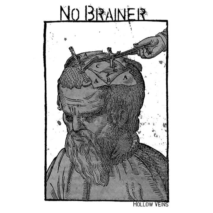No brainer