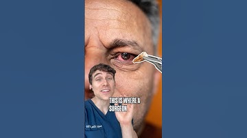 This Surgery Uses Teeth To Fix Blindness (Tooth in Eye Surgery)