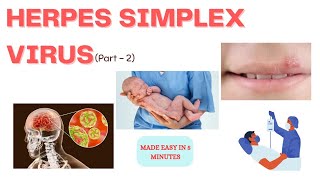Herpes simplex virus | Treatment | In just 5 minutes | Medinare