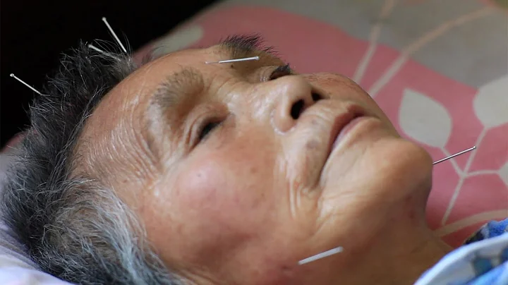 真實中國紀錄片《針灸》第三集：不要拿別人的過錯來懲罰自己 - 天天要聞