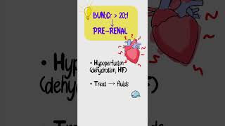 AKI Made Easy in 45s | USMLE Step 1 High-Yield Algorithm (BUN:Cr + Causes)