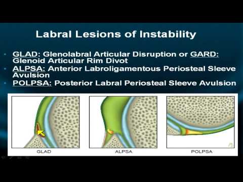 Videó: Honnan származik a periosteum?
