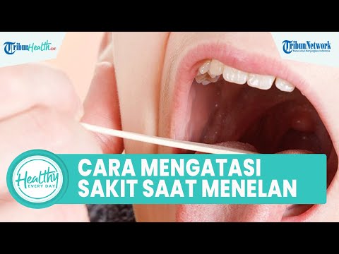 Sakit saat Menelan akibat Radang Amandel, Inilah Cara Atasi dengan Obat
