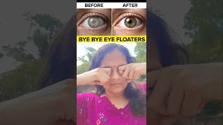 Floaters Aur Eye Strain Ko Kam Karne Ka Simple Massage 🔥 #shorts