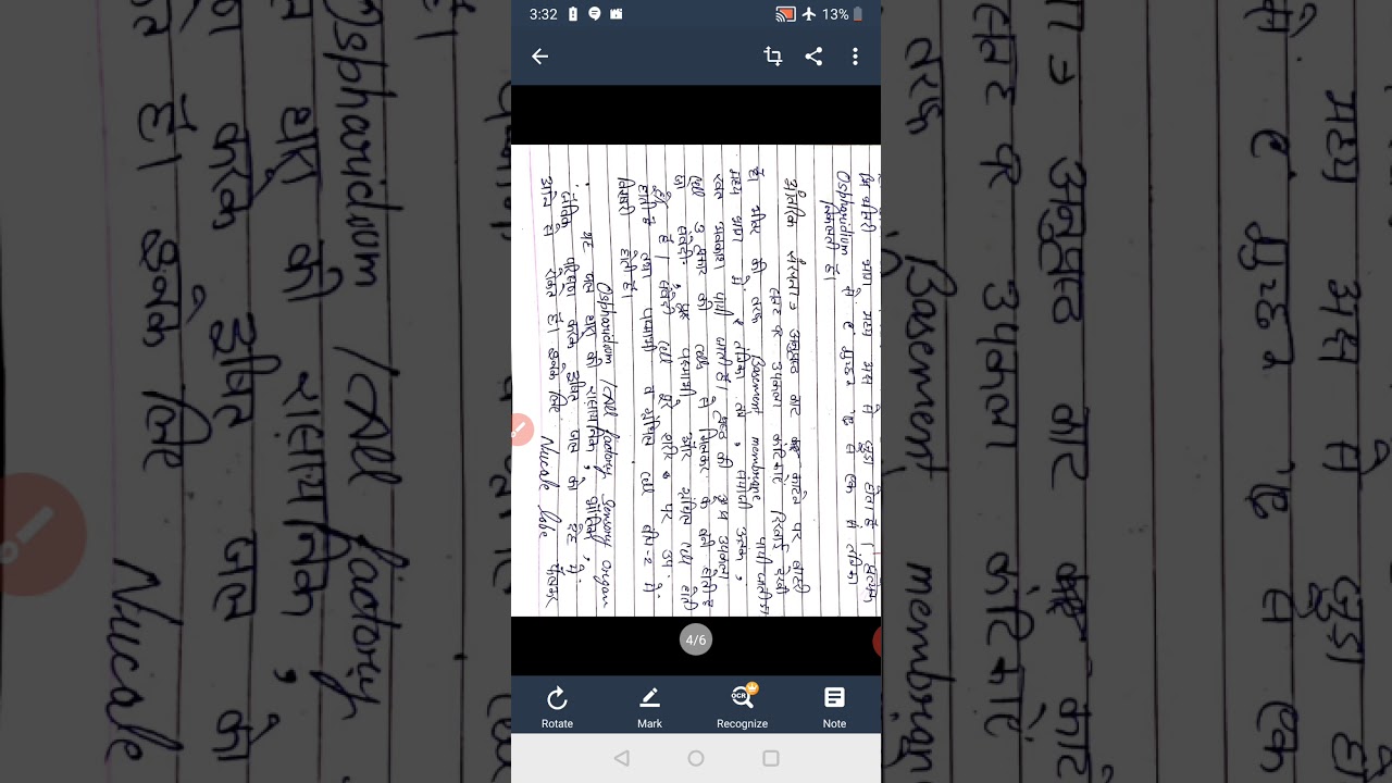 Statocyst of unio and ospherediam of pila