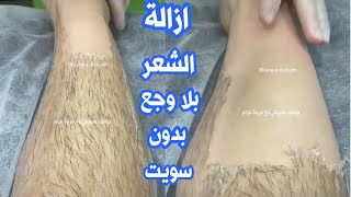 إزالة شعر الوجه والجسم ليلة العيد من أول استخدام في ربع ساعة من غير سويت ولا شفرات ولا وجع نهائياً