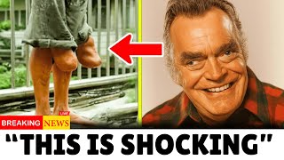 These Hollywood Actors With The Weirdest Body Parts