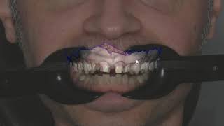 Masterclass Digital Smile Design 3Rd July 2019