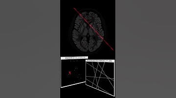 PET sinograms & backprojection