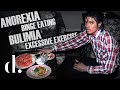 Michael Jackson's Secret Eating Disorder | the detail.