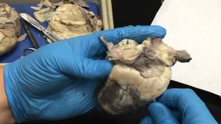 Sheep Heart Dissection - Mira Costa College; Mr. Jones