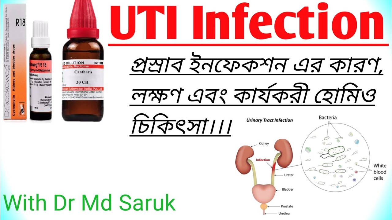 UTI Infection। Urinary Tract Infection Homeo Treatment In Bengali
