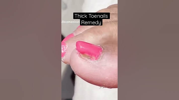 Thick toenails remedy. Let me show you how to restore your nails :) #dremel #electricfile #toenails
