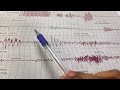 Breath Holding | Stethography Physiology Practical | Sagarika Basavaraj
