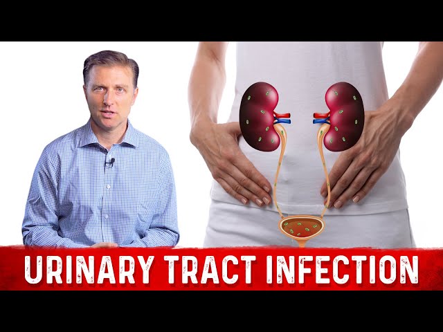 Best Home Remedy for Urinary Tract Infection (UTI) – Dr. Berg class=